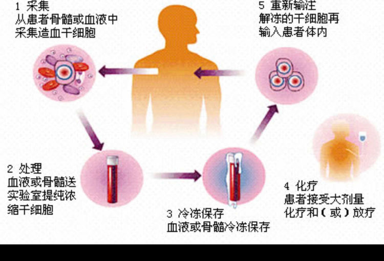 晶化骨髓_晶化骨髓具体位置_晶化骨髓长啥样