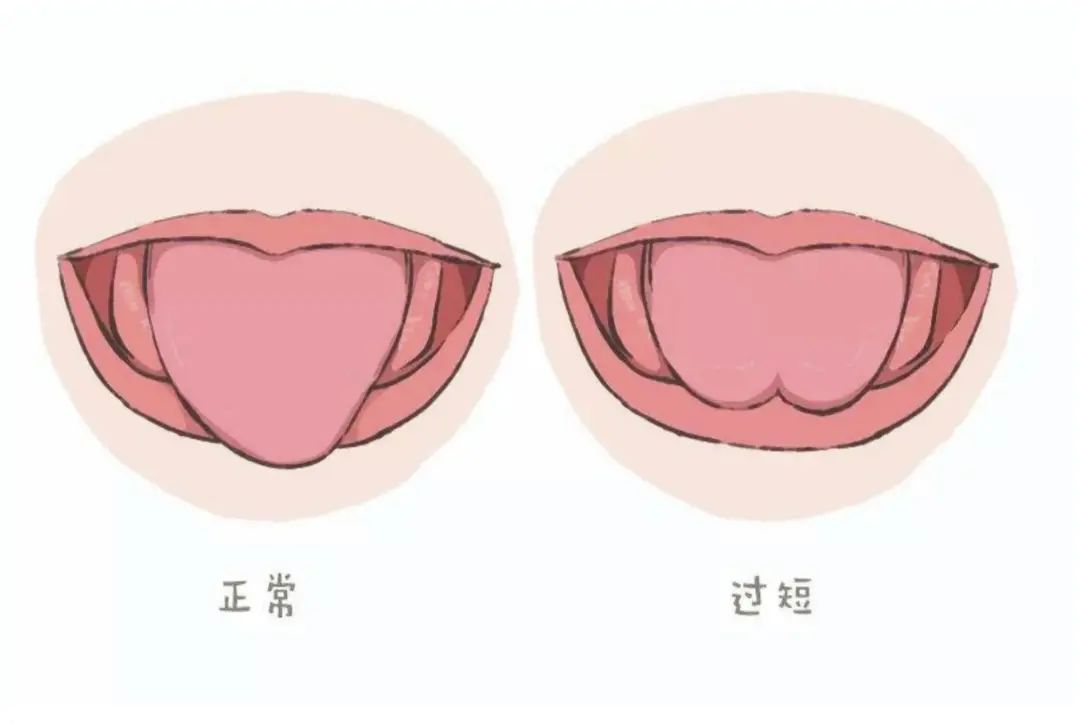 口工游戏_口工游戏_口工游戏